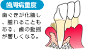 歯周病十度